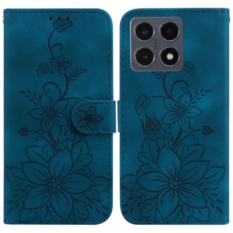 Housse Xiaomi 15T Lys